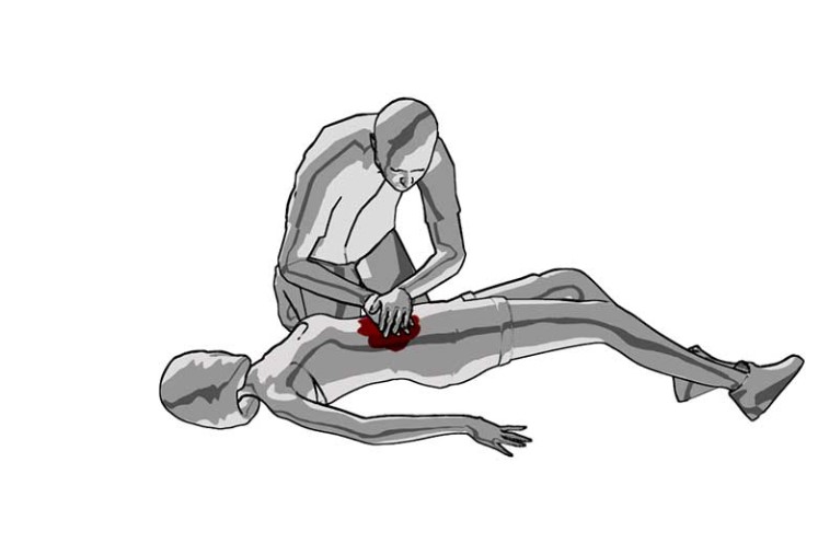 Step 1: controlling bleeding that is not on arms or legs